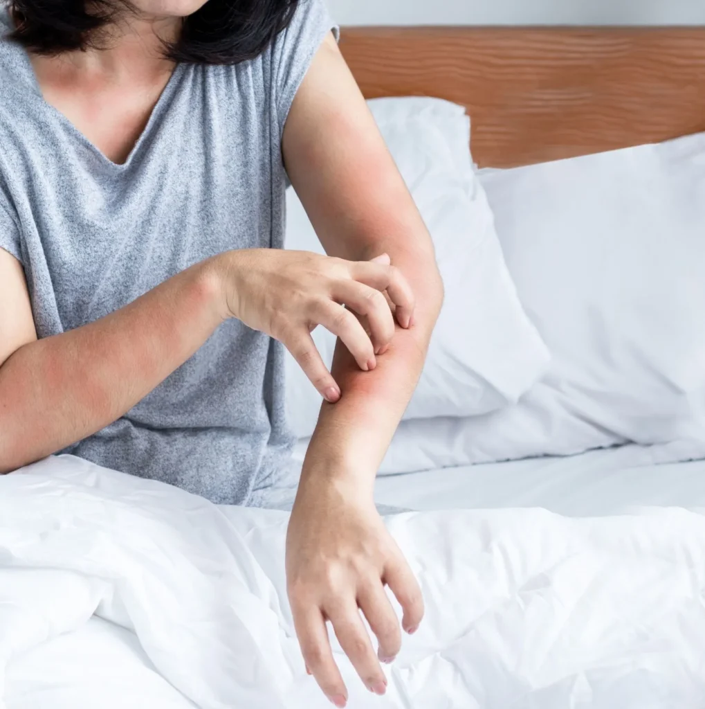 Why-Bed-Bug-Heat-Treatments-Work-Best